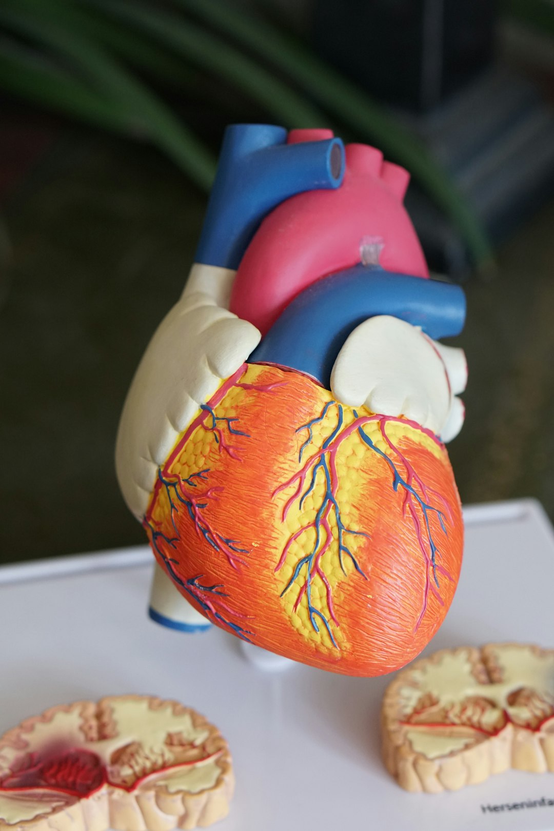 Dr. Sarah Johnson, Cardiologist